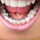 Fachzahnarztpraxis für Kieferorthopädie München innenliegende Zahnspange