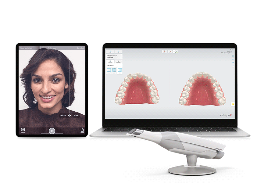 Before and After Scan Patient